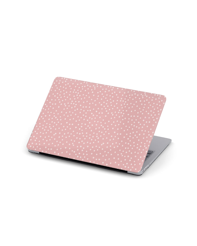 MACBOOK CASE - BALLERINA