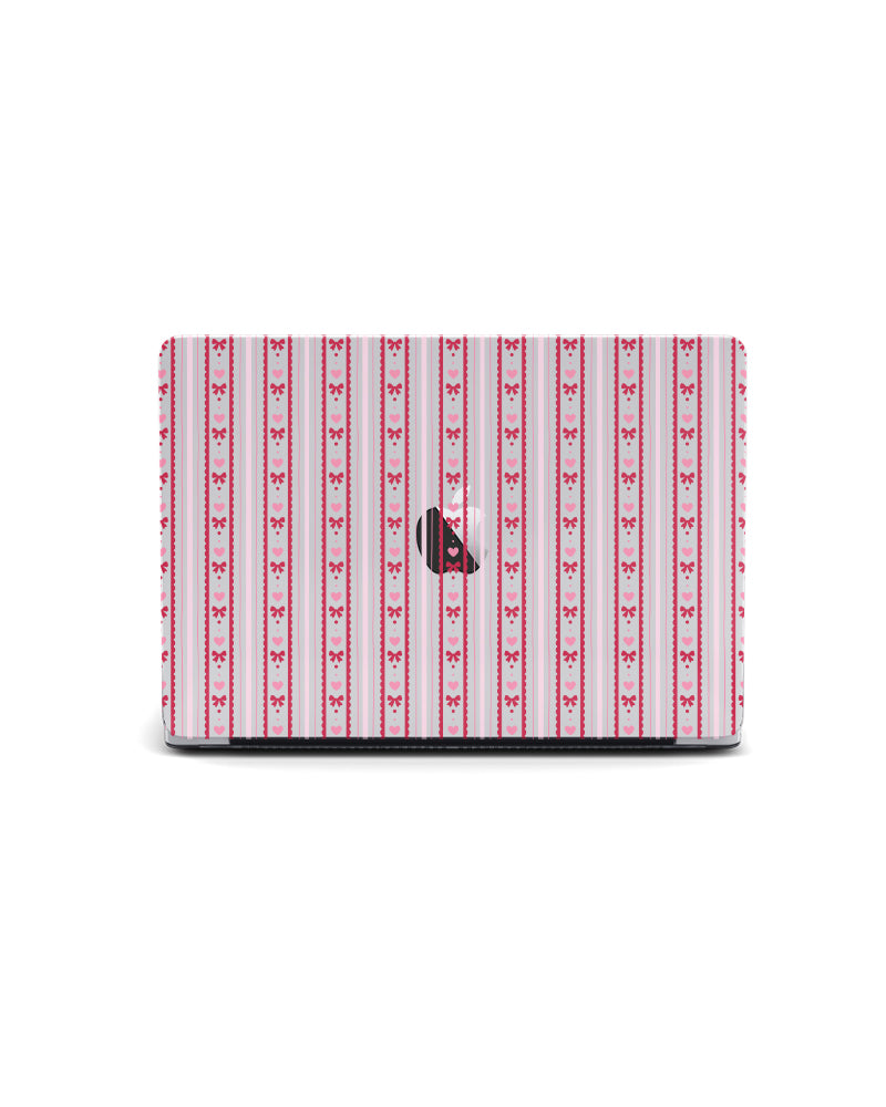 MACBOOK CASE - HEARTSRTINGS