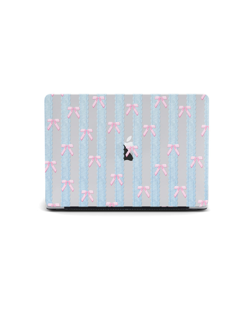 MACBOOK CASE - LACE & BOWS