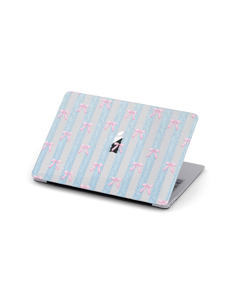 MACBOOK CASE - LACE & BOWS