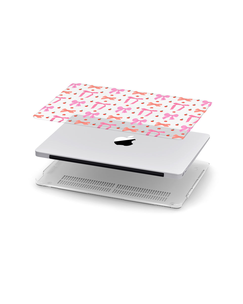 MACBOOK CASE - SWEET BOWS