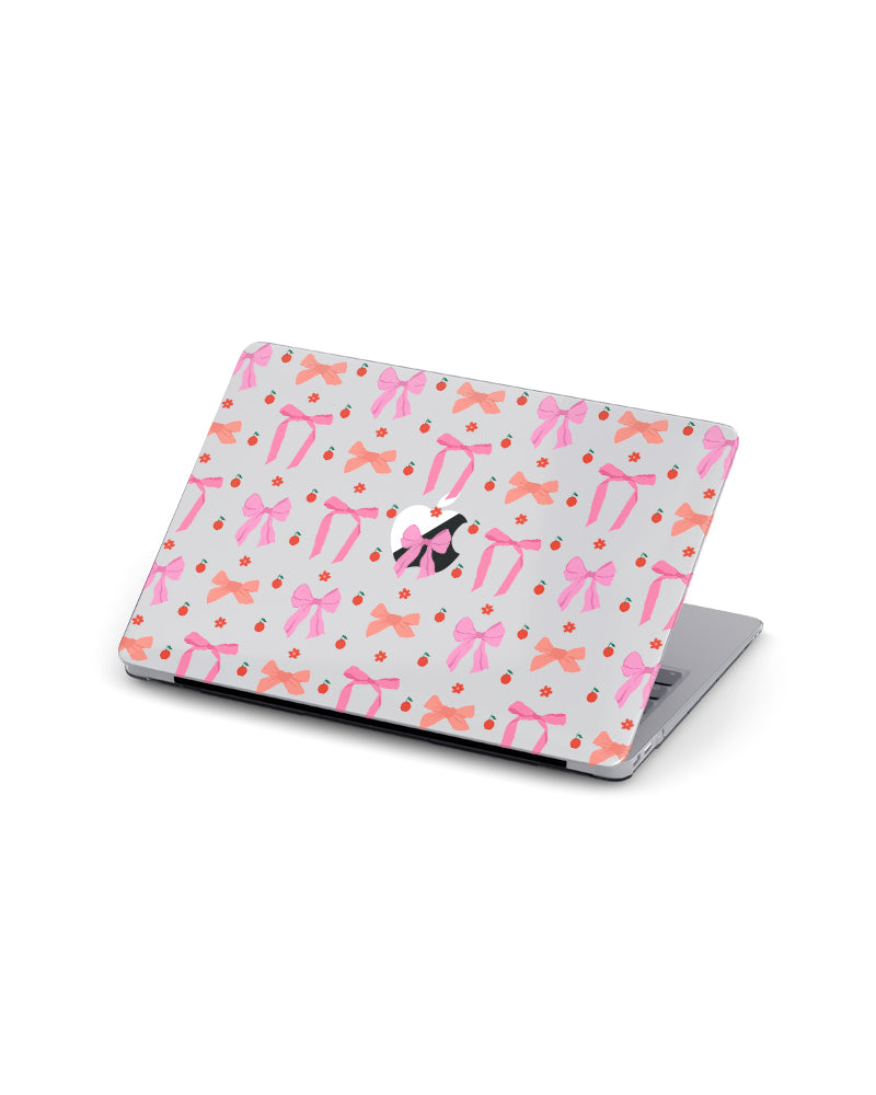 MACBOOK CASE - SWEET BOWS