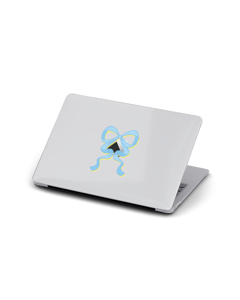 MACBOOK CASE - BLUE ON YELLOW