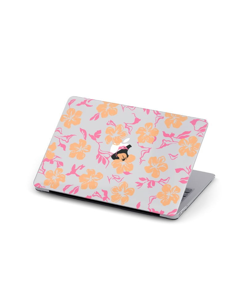 MACBOOK CASE - TROPICAL SUNSET