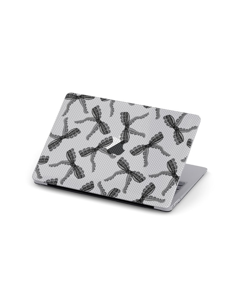 MACBOOK CASE - TWILIGHT LACE