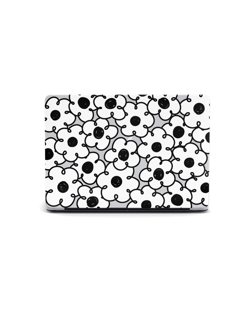MACBOOK CASE - FLOWERS FIELD