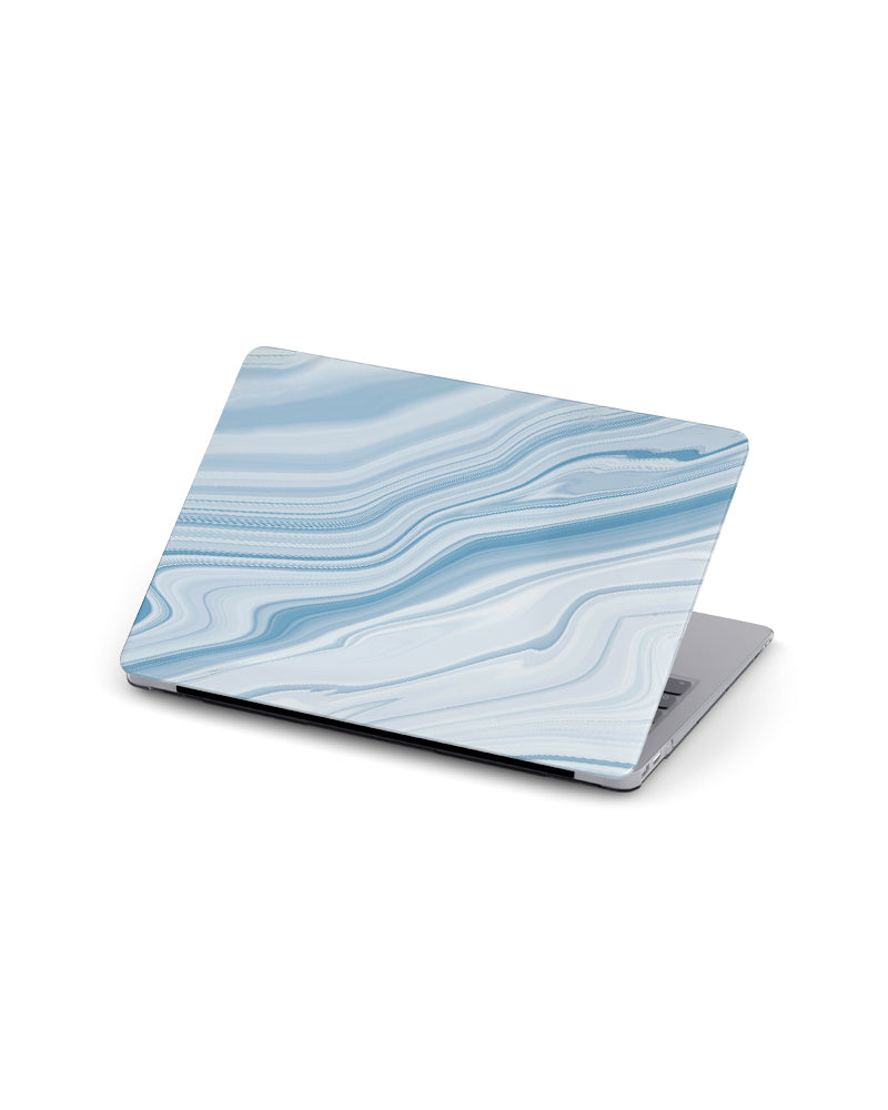 MACBOOK CASE - SKY BLUE MARBLE